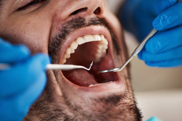 Best 24-Hour Emergency Dentist in Mansfield Center, CT