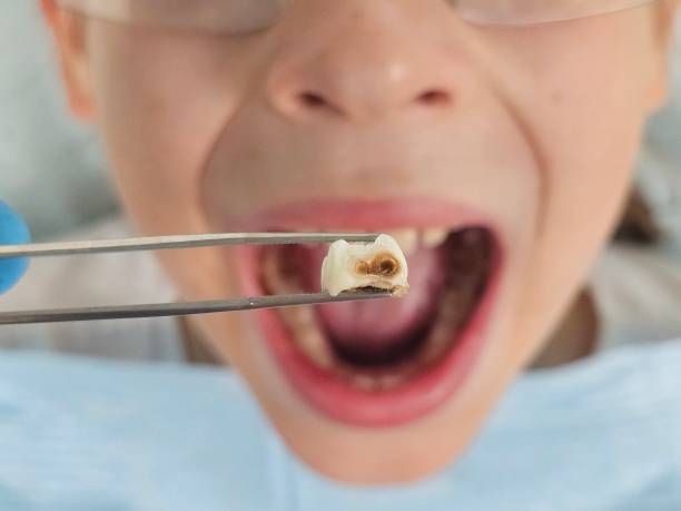 Best Emergency Dentist for Special Needs Patients in Mansfield Center, CT